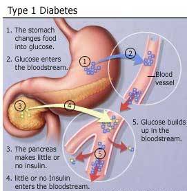 Enzyme restores function with diabetic kidney disease
