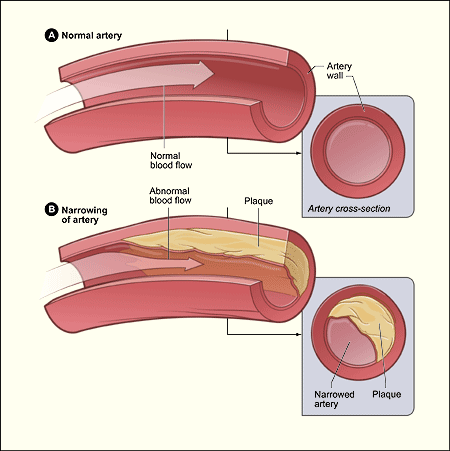 herbal remedies for cholesterol