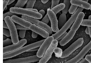 E-Coli Infection Claims 2 More Lives In Germany