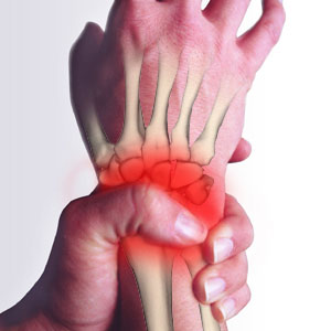 Herbal Remedies For Rheumatoid Arthritis